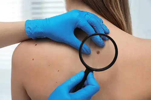 Dermatologia